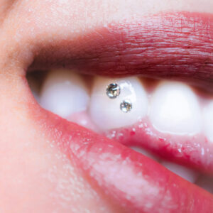 Curso de Gemas dentales